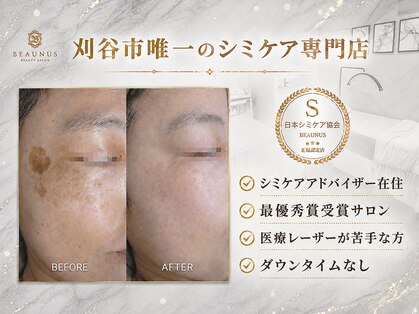 ビューナス(BEAUNUS)の写真