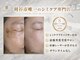 ビューナス(BEAUNUS)の写真