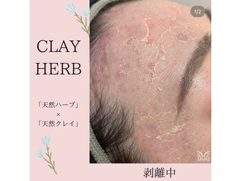 スリジエ ボーテ(cerisierBEAUTE)/剥離ありハーブピーリング☆