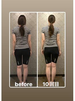 プルーム 大橋店(plume)/10回来店40代女性/肩と腰の痛み