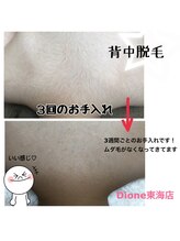 レイラニア(Leilani.Am)/背中脱毛