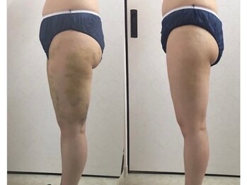 シルク ド ココ(Silk de Coco)/インディバボディ