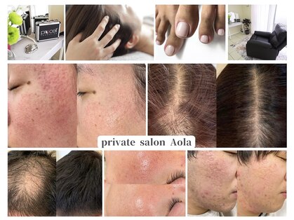 アオラ(Aola)の写真