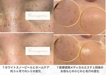 リ ミュール(Ri.miyuru)