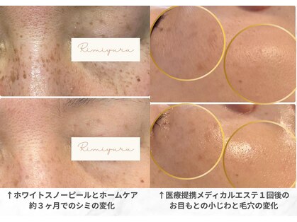 リ ミュール(Ri.miyuru)の写真