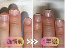 ケアリ(CAREri)/看護師さん、保育士さんも♪