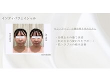 ココーラ(COCCOLA)の雰囲気（施術後直ぐに効果が！！！）