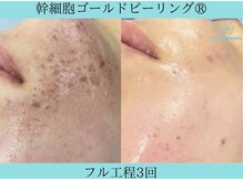 リメイククリニカルビューティー(Remake clinical beauty)/