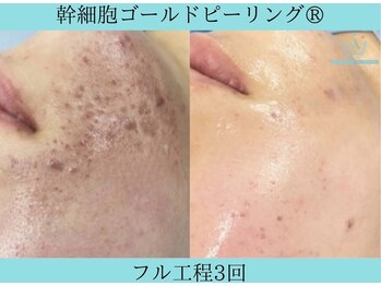 リメイククリニカルビューティー(Remake clinical beauty)/