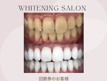 ホワイト つくば店(WHITE)/