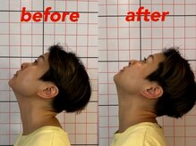 プーラビタ(PURAVITA)/首こり可動域改善 before after