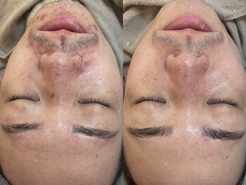 ビーマジック(Be Magic)/メンズ&眉毛&エステ