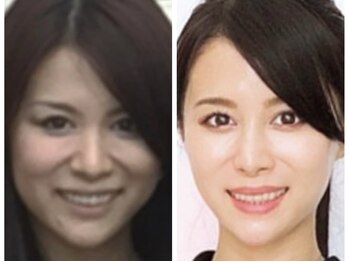 ナオフクオカ ヒーリングフォースエヌ(NaoFukuoka/healingforceN)/サロンケア&ホームケアで別人級