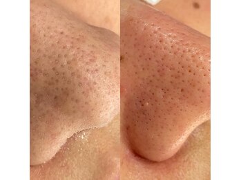 メゾン ド エム(maison de M)/