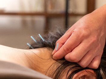 リゾート(Resort)/【首こり＊鍼灸】