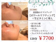 クレル(Clair)