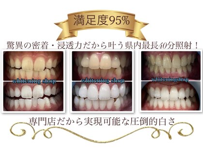ホワイトニングショップ 明石大久保店の写真