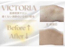 ファッシモ(fascimo)/