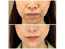 スパ アールアンドビー(SPA*R&B)