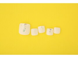 フットネイル