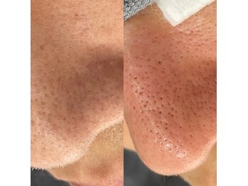 メゾン ド エム(maison de M)/