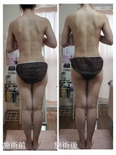 紬(TSUMUGI)/整体とリンパマッサージ