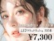 ESRの写真