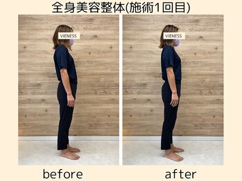 ヴィーネス(VIENESS)/【全身美容整体/姿勢/骨盤矯正】