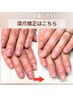 【1回で見た目改善】深爪矯正◎人前で出せる自然な指先へ導きます　¥23100→