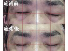 深眠プロの雰囲気（一度の施術で【即実感】スッキリ爽快♪仕事のパフォーマンスUP☆）