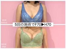 ククナ 新潟本店(KUKUNA)/＊バストアップケア＊