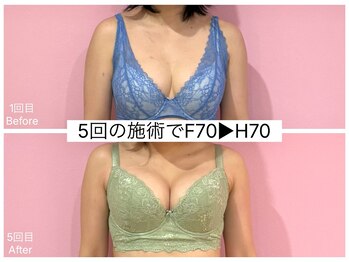 ククナ 新潟本店(KUKUNA)/*バストアップケア*
