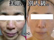 ドクターヴィー 高知(DrVi)/どこまでも透明度の高いお肌に