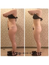 インタークロス(intercross)/痩身て若々しい後ろの姿も！