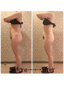 インタークロス(intercross)/痩身て若々しい後ろの姿も！