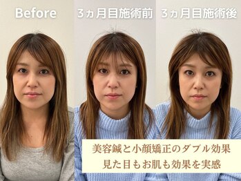 蓮子堂鍼灸整体院/小顔になるなら当店へお任せ♪