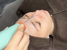 ラバンサラ(Ravan Sara)/プラズマフェイシャル