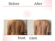 サロンツキ(salon tuki)/バストアップ