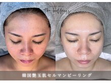 ザ ベルネス(The bellness)の雰囲気（大人が選ぶピーリング。自然の艶が内側から発光する輝きを）