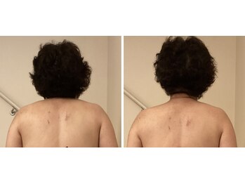 リミュール(Ri.miyuru)/首肩&腰に リンパマッサージ