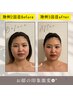 【お顔の土台を整える】オーダーメイド小顔調整　90分　12400円