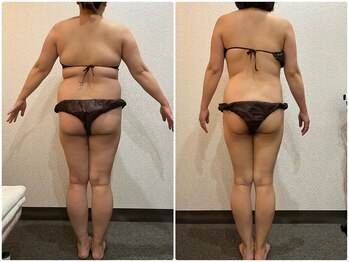 美容整体 ウェリナ 蟹江院/小顔矯正/骨盤矯正/美脚サロン