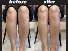 クリア(clear.)の雰囲気（ケアも充実. foot spa.handspa オススメInstagram@_____ari_cl）