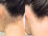 もう悩まない【えりあし+うなじ脱毛】お悩みに合わせたデザイン技術が人気◎