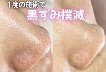 ベベ(bebe)