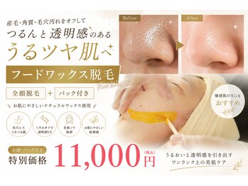 あすはれの写真/顔の産毛、鼻の黒ずみ・角栓、鼻下の毛や白くなった毛にも◎WAX脱毛でつるつるに![築地/東銀座/顔脱毛]