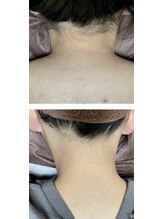 ファミリーセルフサロン 輪(Wa)/うなじ・背中きれいですか？