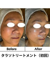 ルアナ 北谷店/タラソケア 《沖縄/北谷》