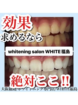 ホワイトニングサロン ホワイト(WHITE)/セルフホワイトニング/大阪/福島