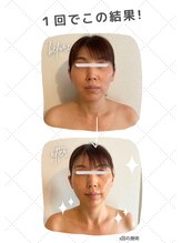 マナワ(Manawa)/美人度UP/1回のビフォーアフター